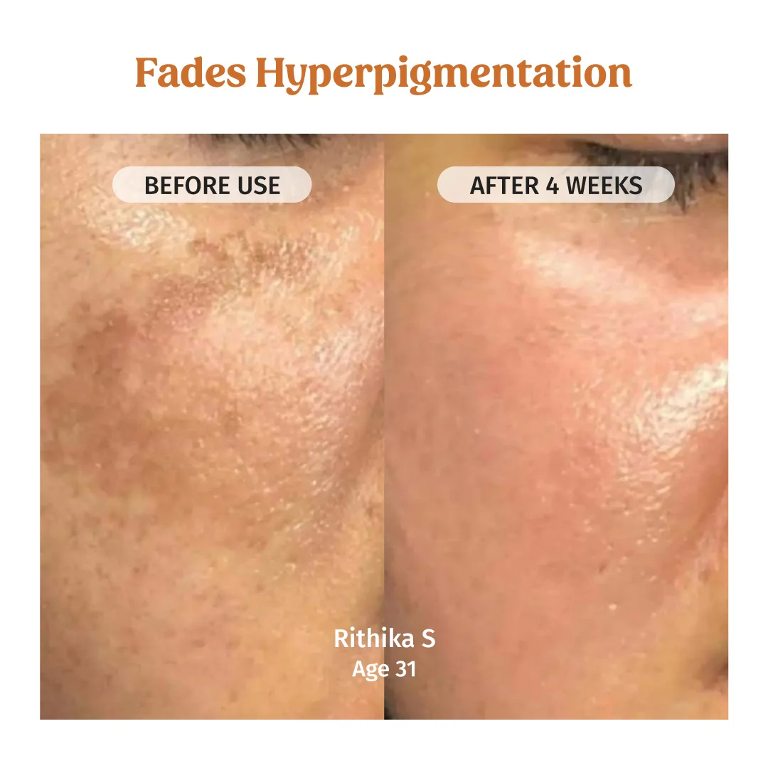 Face Brightening Combo - Image 3