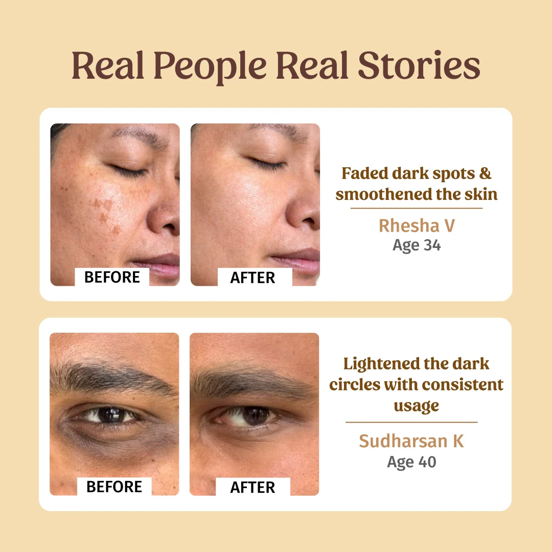 Face Lift Combo - Image 5