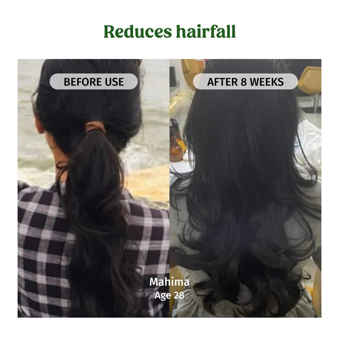 Hair Regrowth Oil - Image 5