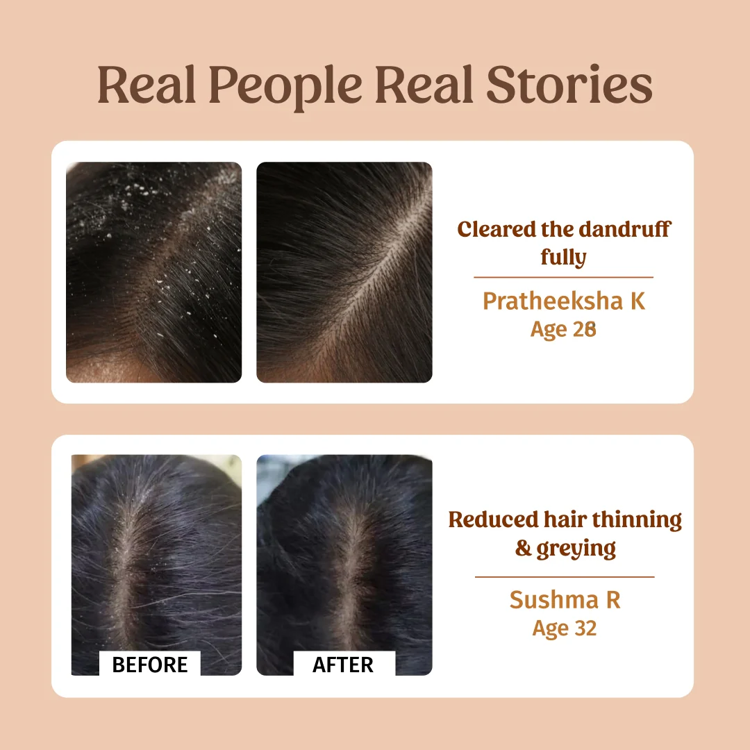Herbal Shampoo (Dandruff Control) - Image 4