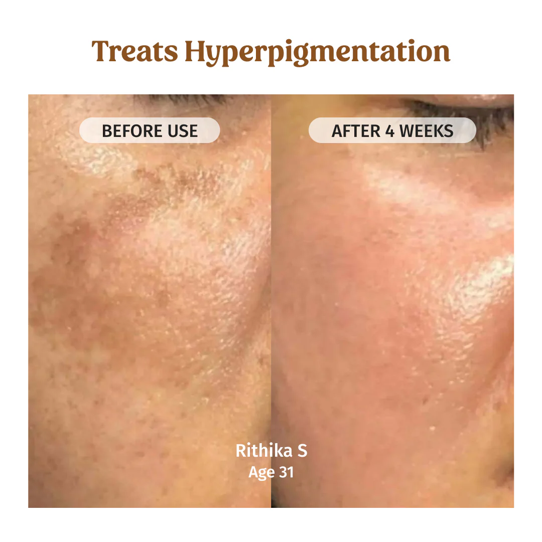 Milk Drops Brightening Serum - Image 3