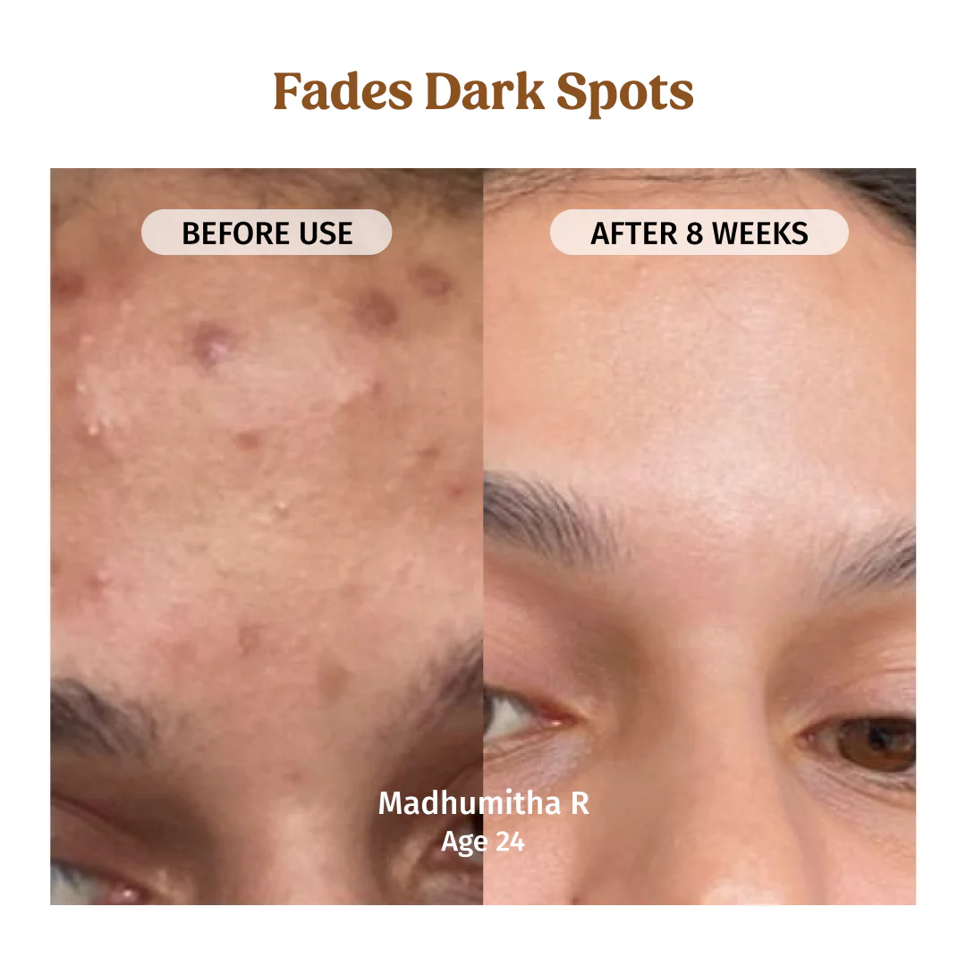 Milk Drops Brightening Serum - Image 4