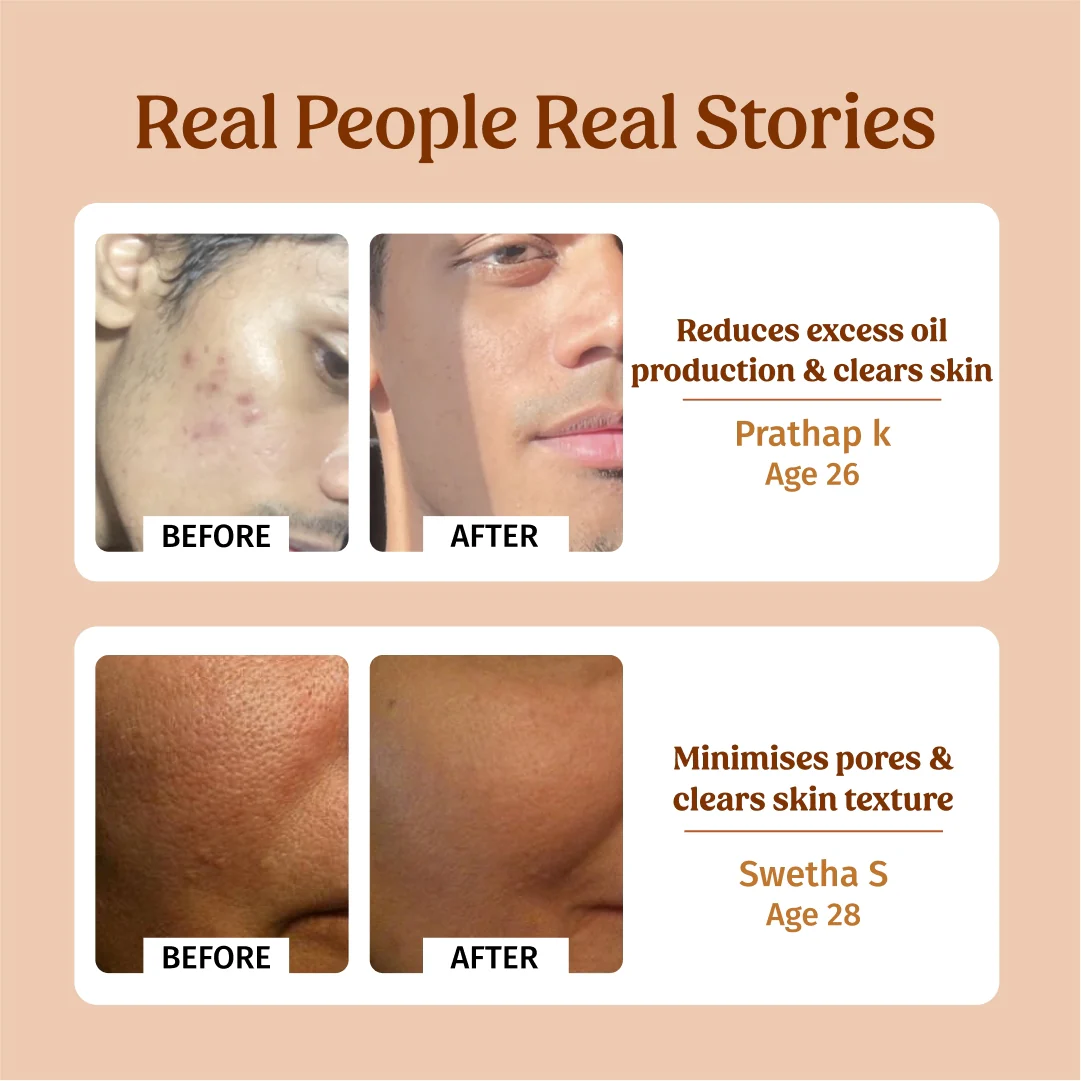 Milk Face Toner - Image 5