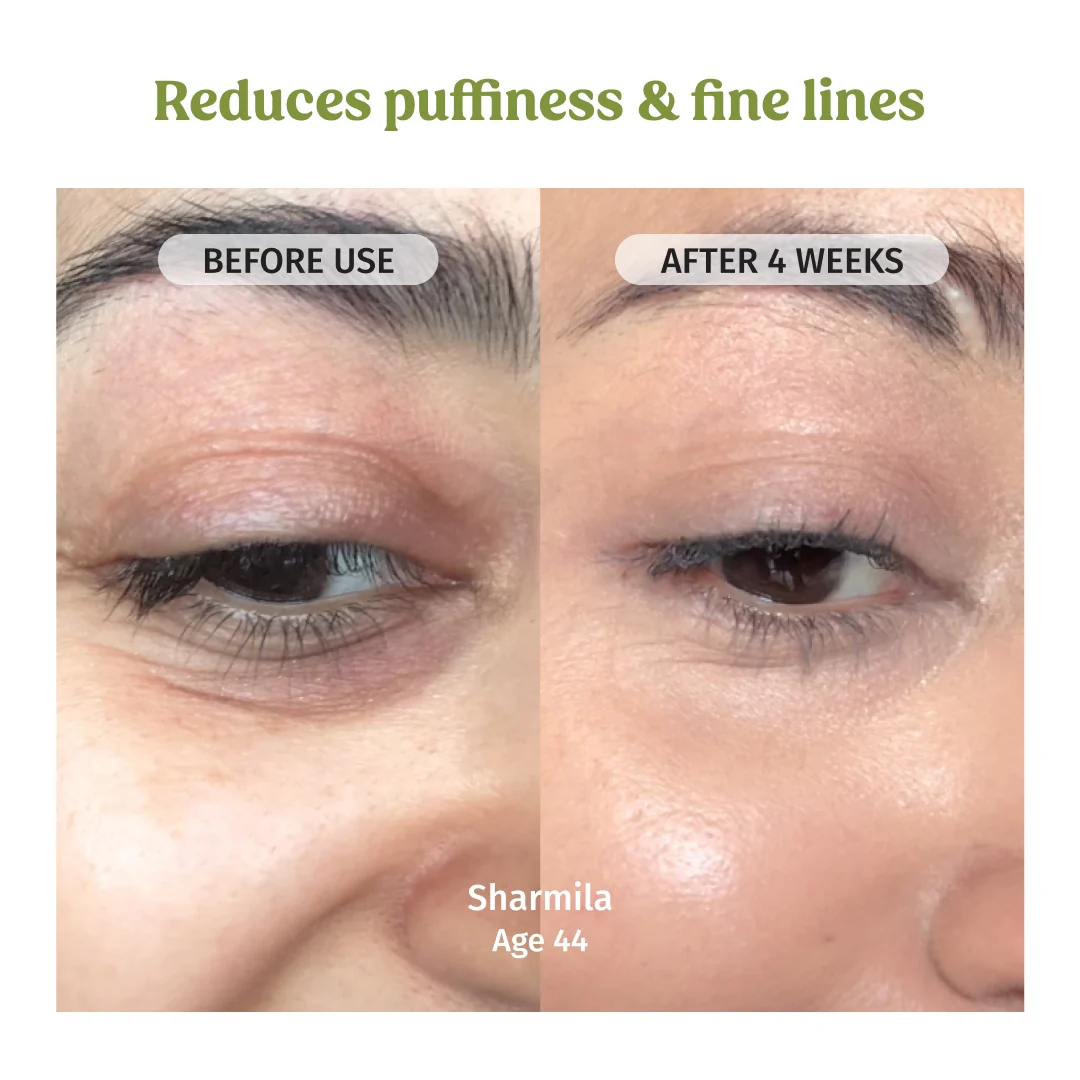 Under Eye Cream (Dark Circles Control) - Image 3