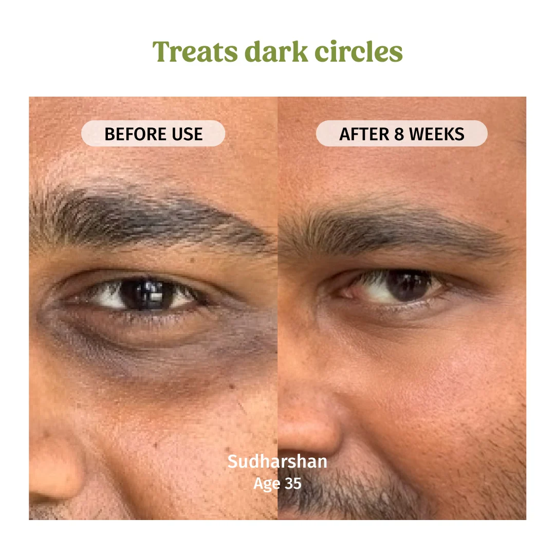 Under Eye Cream (Dark Circles Control) - Image 4