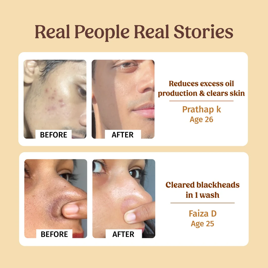 Pore Minimising Combo - Image 4