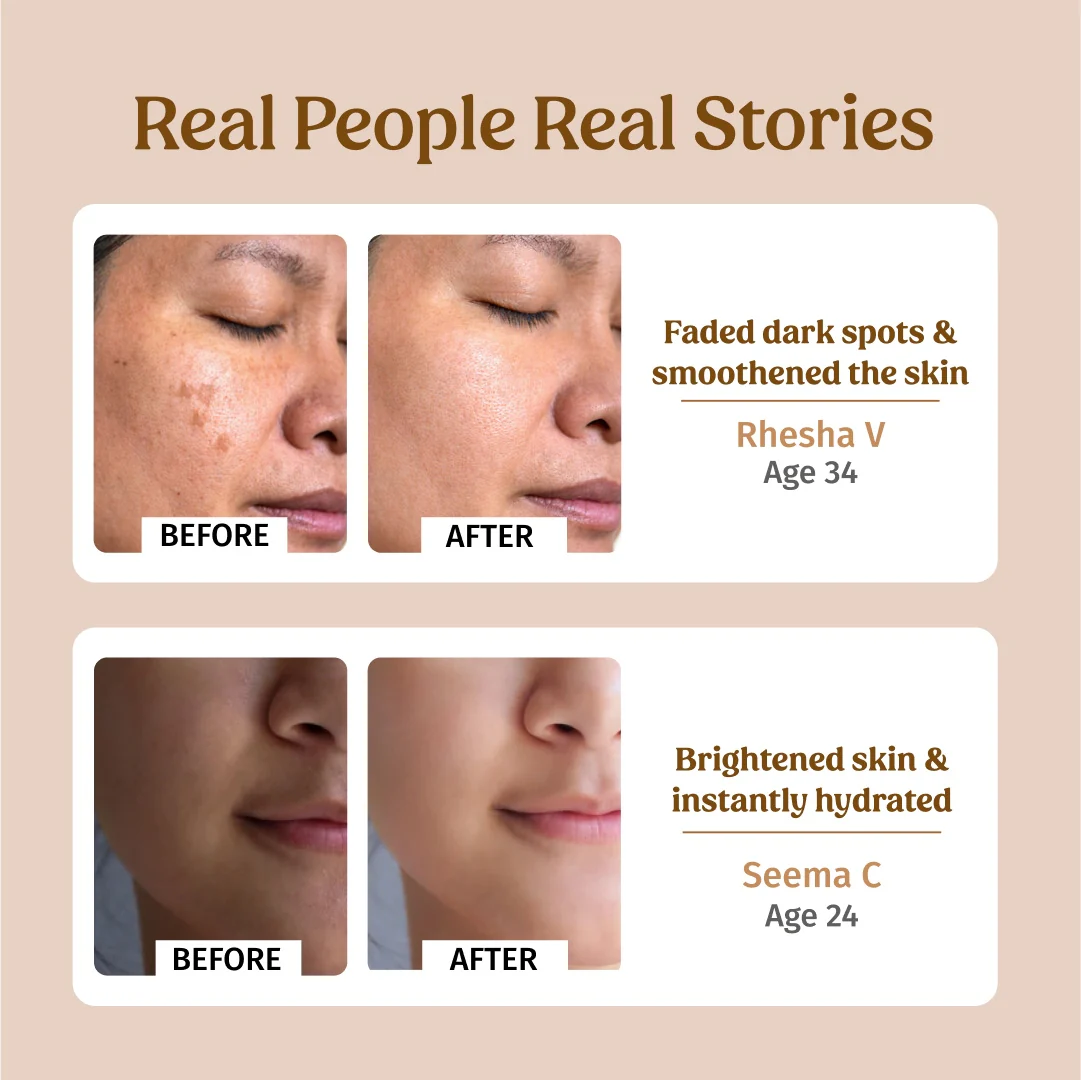 Ultra Moisturising Cream - Image 5